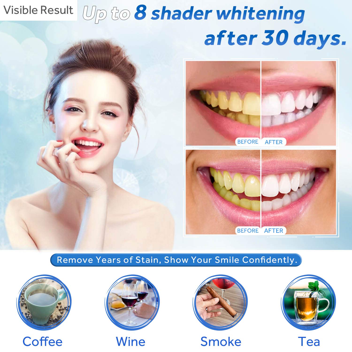 Żel do wybielania zębów w strz – Teeth Whitening Bleach recenzja i cena