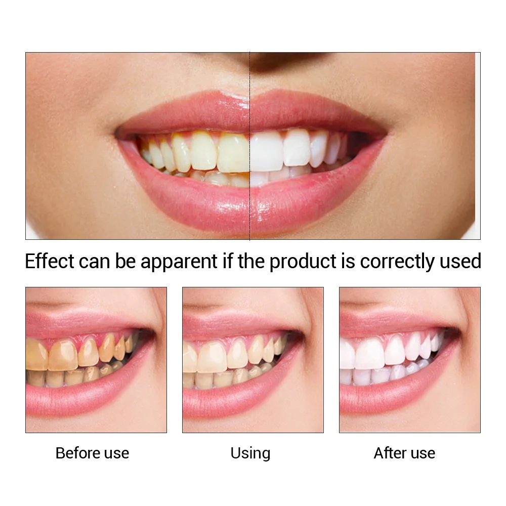 FTEENPLY esencja do wybielania – Teeth Whitening Bleach recenzja i cena