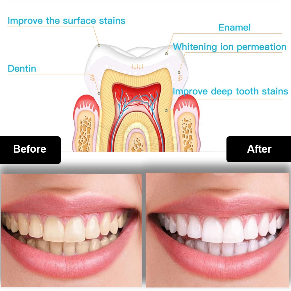 Zestaw do wybielania zębów den – Teeth Whitening That Works recenzja i cena