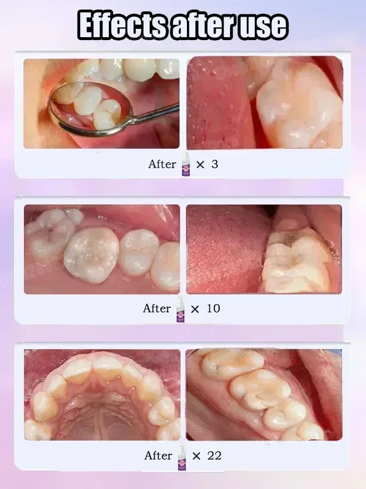 Pasta do czyszczenia zębów usu – Teeth Whitening That Works recenzja i cena