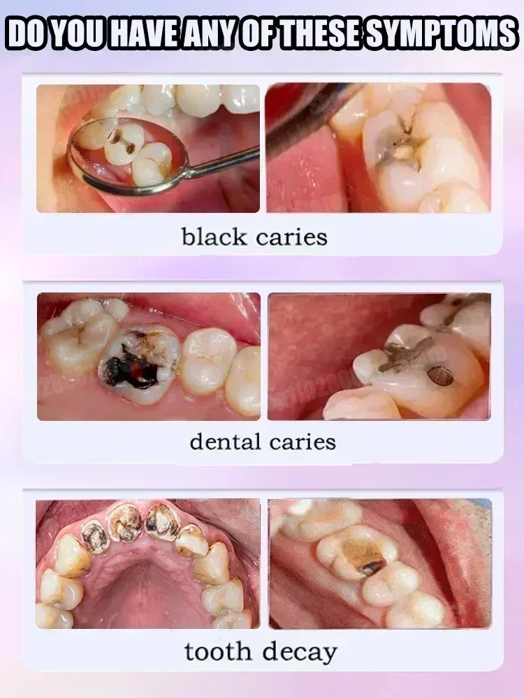 Pasta do czyszczenia zębów usu – Teeth Whitening That Works recenzja i cena
