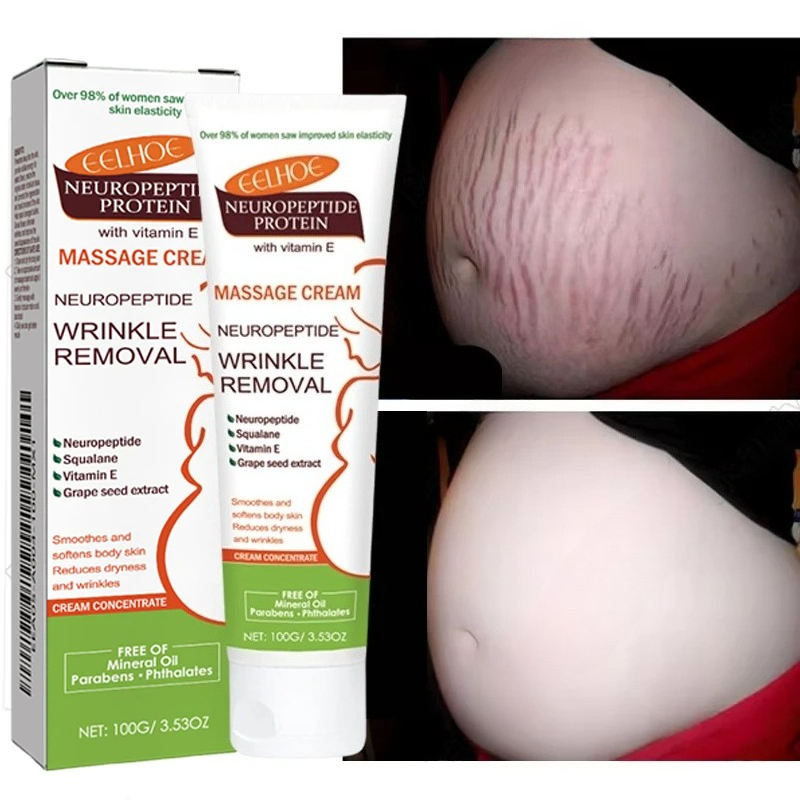 Krem na rozstępy 100g, trwałe  – Teeth Whitening Pregnancy recenzja i cena